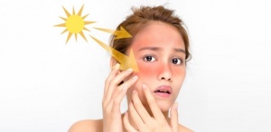 5 мифов о загаре и солнечном облучении